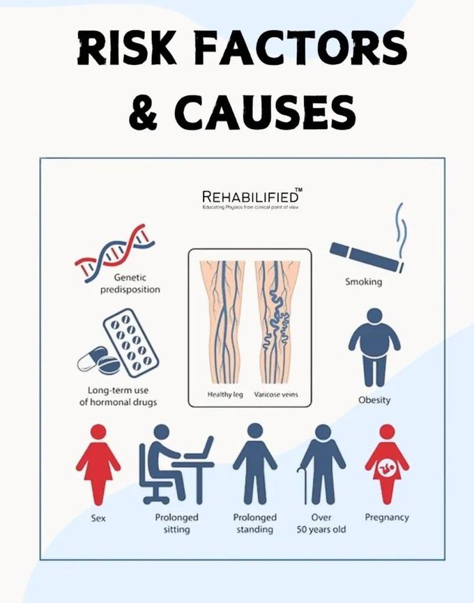 Varicose Veins IV