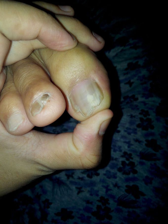 What is  Dx and Rx?