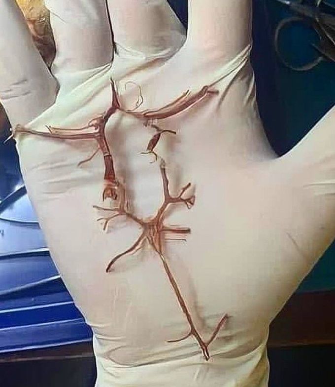 Circle of Willis