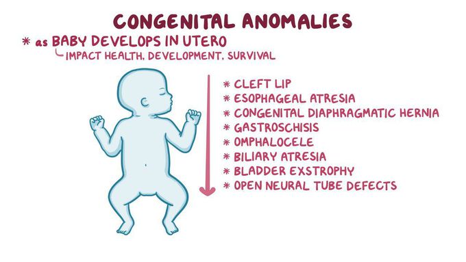 Types of Congenital disorders - MEDizzy