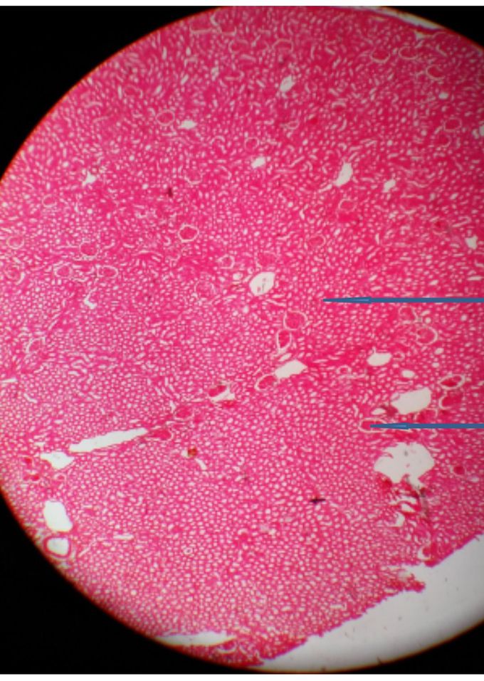 kidney