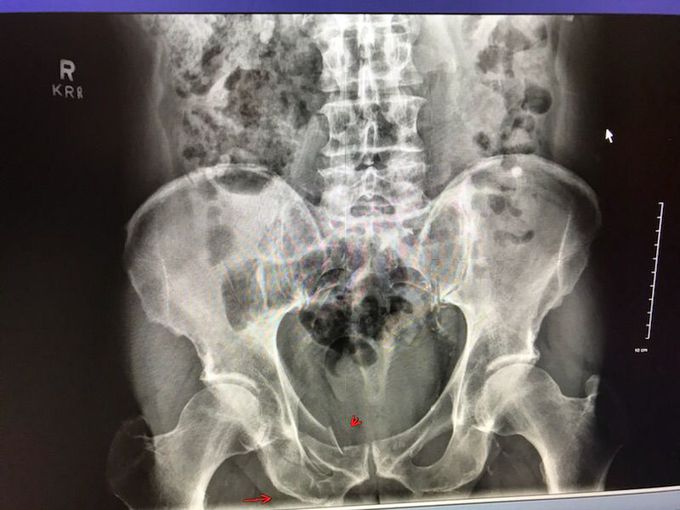 Diagnosis?