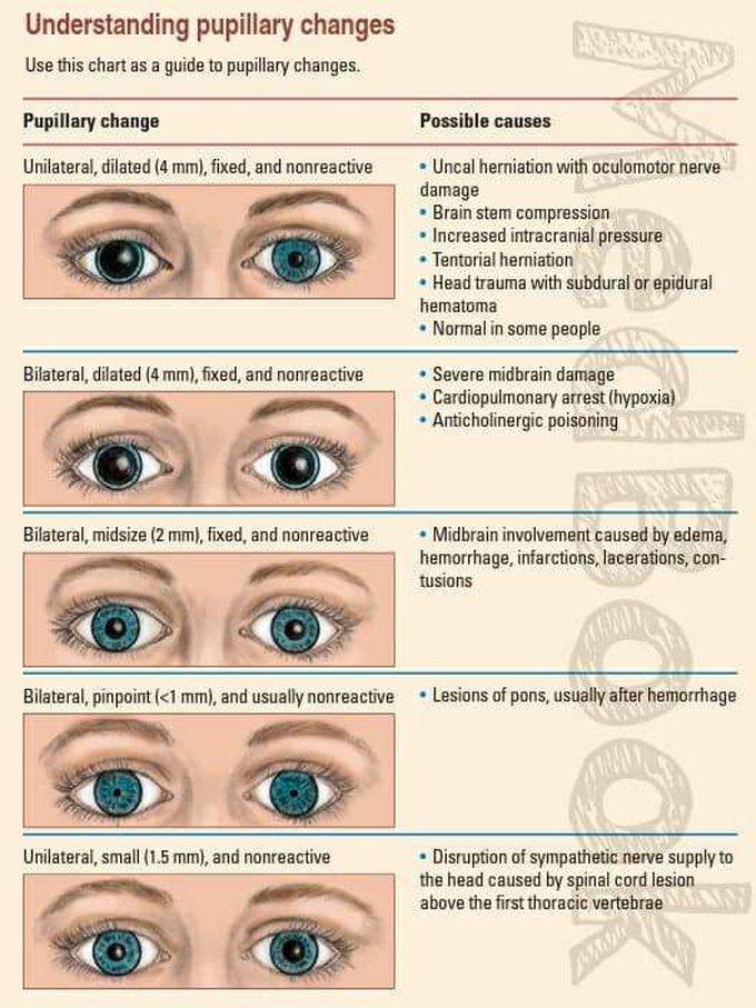 Pupillary changes....