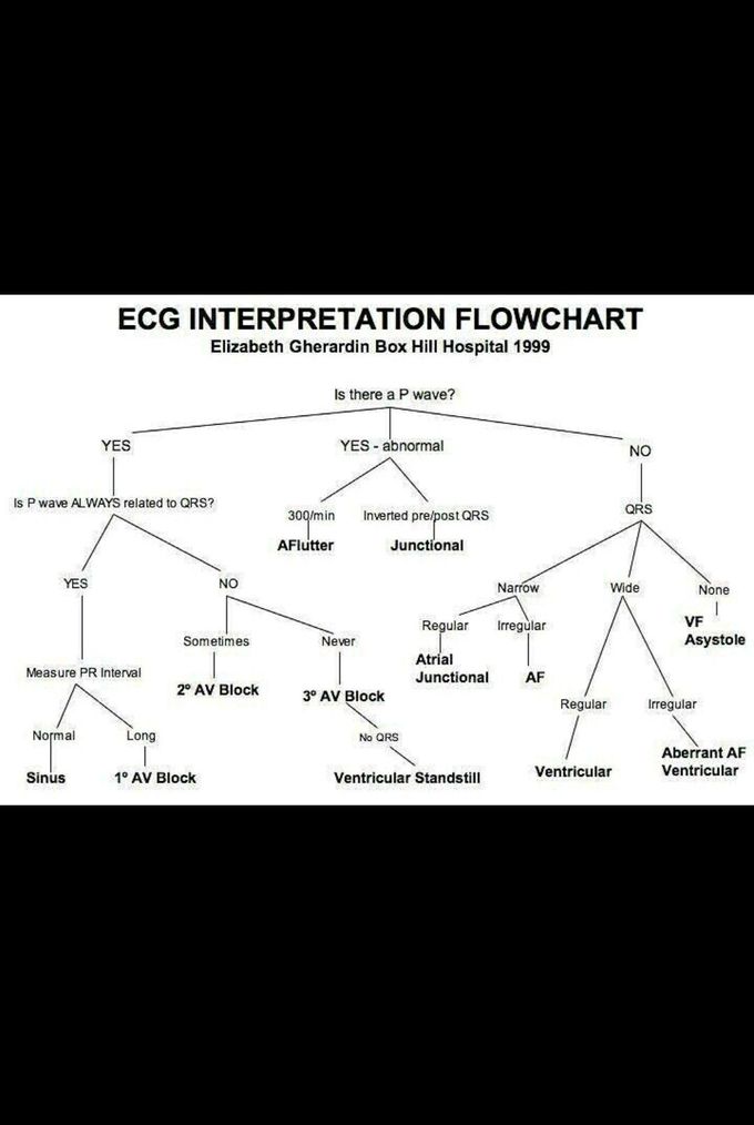 ECG mind maping