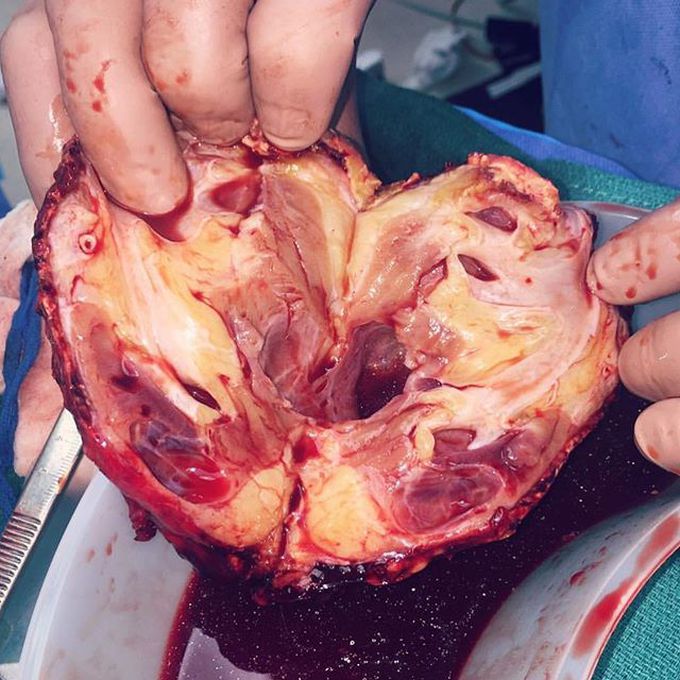 Which organ is being displayed here?