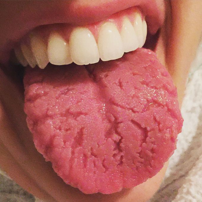 tongue