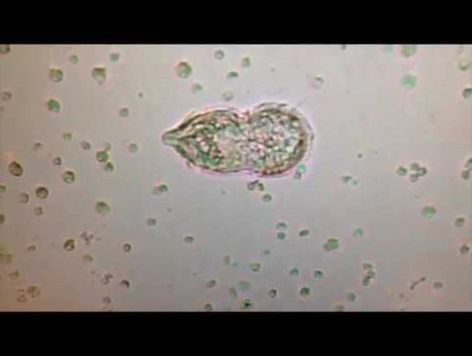Miracidium in Urine Sample from Child with Gross Hematuria