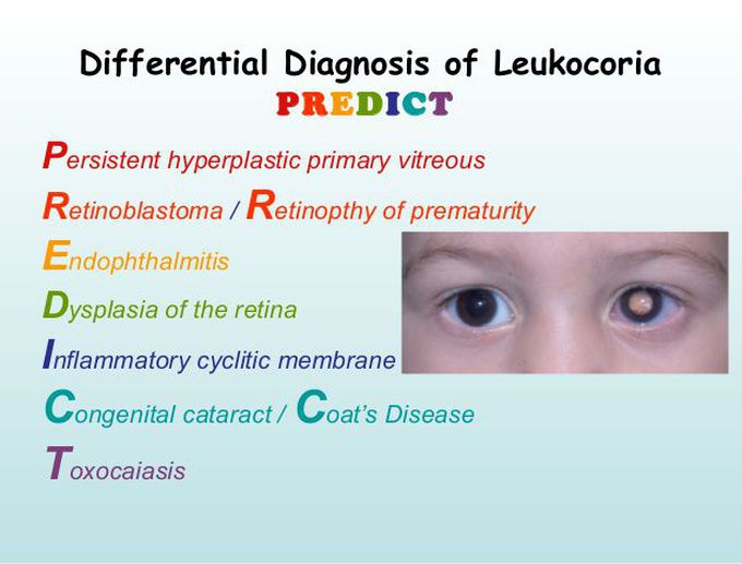 PREDICT the cause of White Eye Reflex!