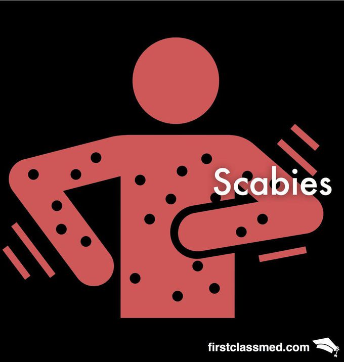 Scabies - The Itch that drives you mad