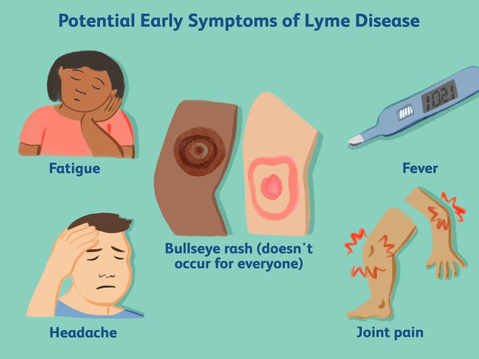 Symptoms of Erythema migrans