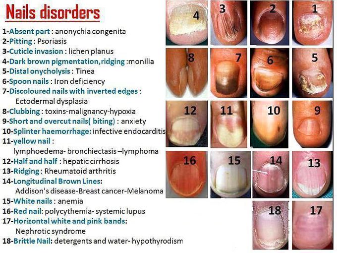 Nail disorders