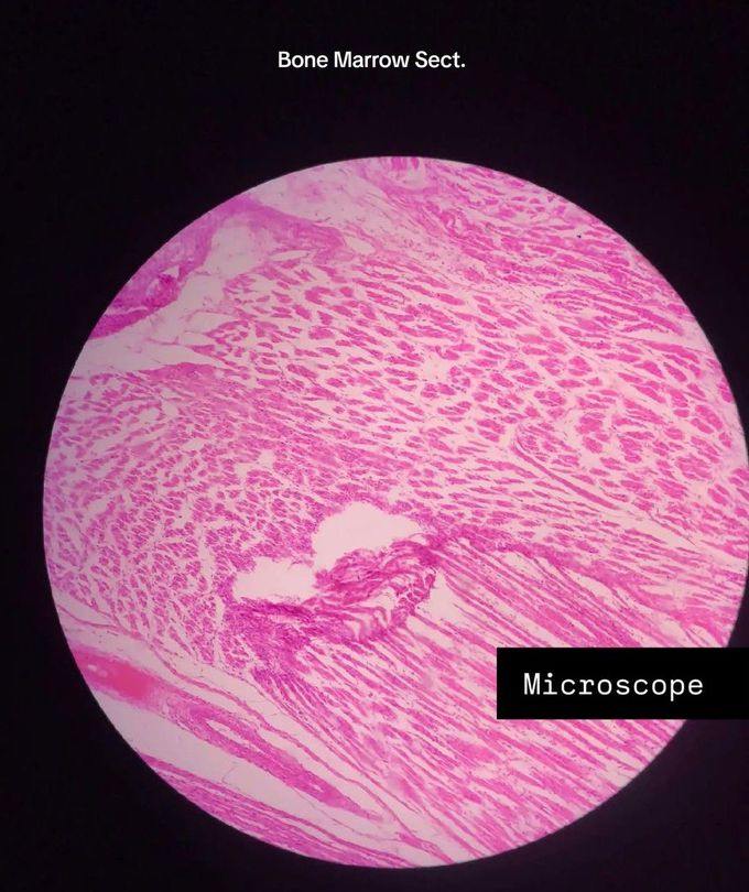 Bone Marrow Section Histology