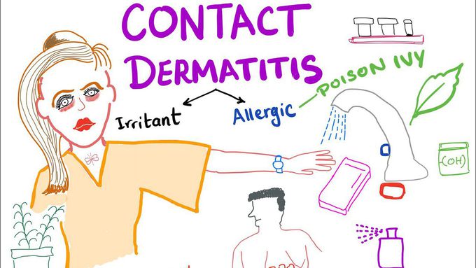 Contact Dermatitis