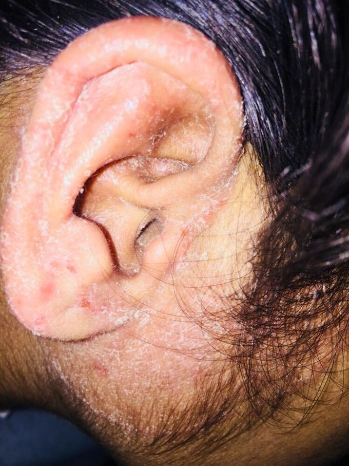 What is your diagnosis and treatment???