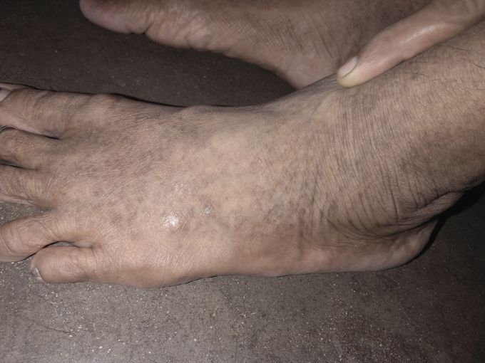 Diagnosis please??