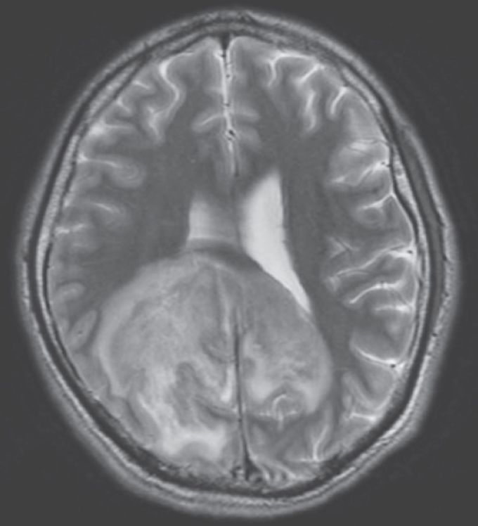 What is your diagnosis???