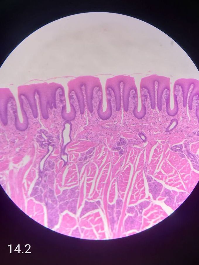 histología de papilas foliadas