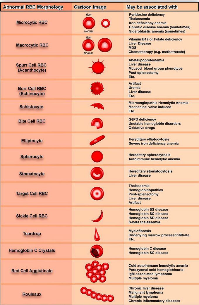 Morphology of RBC