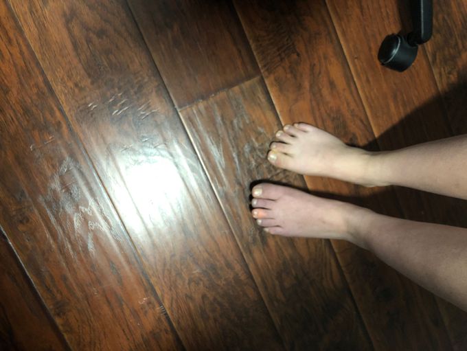 Broken, cracked or dislocated need help immediately