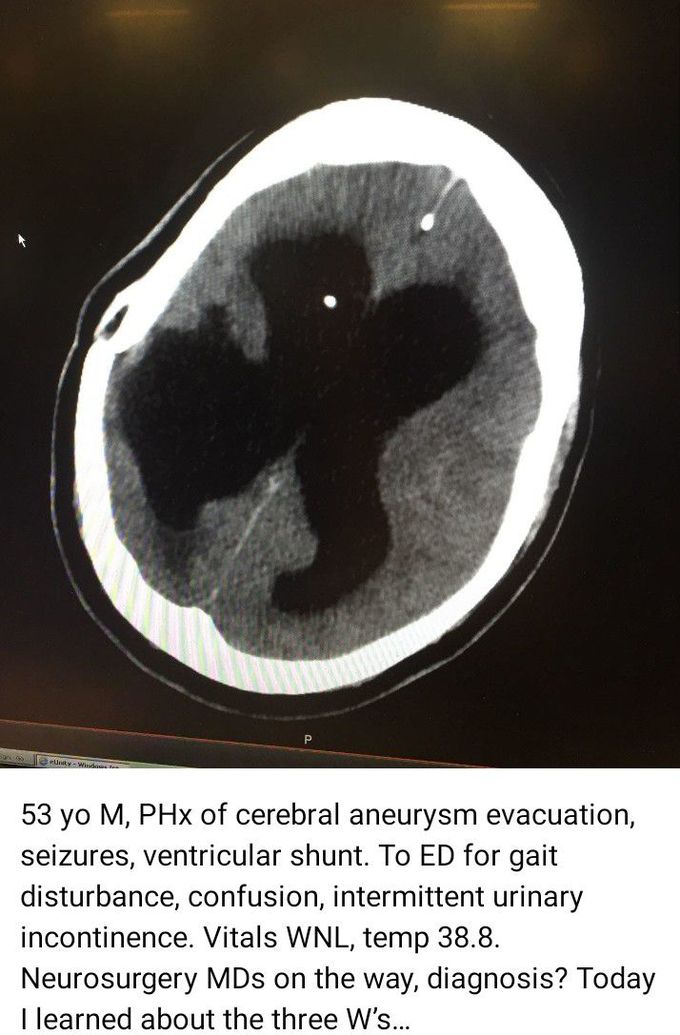 Neurosurgery