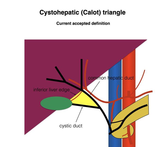 Calot's triangle