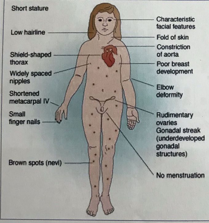 Diagnosis?? - MEDizzy