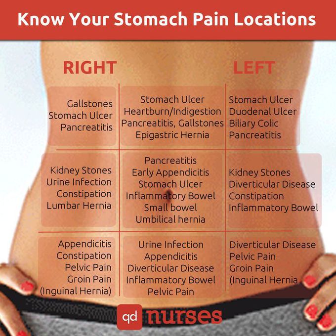 Know Your Stomach Pain Location - QD Nurses | Nursing | Pinterest | Medical, Nursing students and Nclex