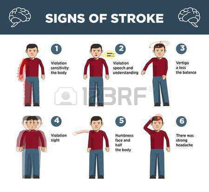 Heart stroke symptoms