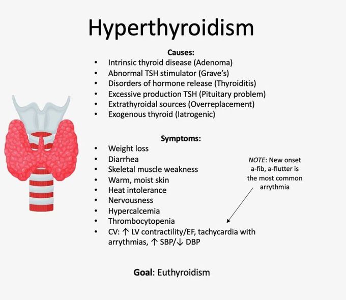 Hyperthyroidism II