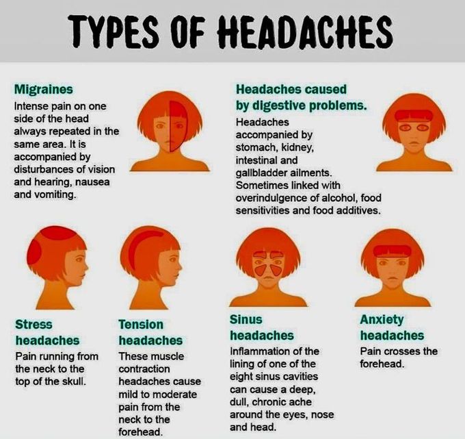 Types of Headache - MEDizzy