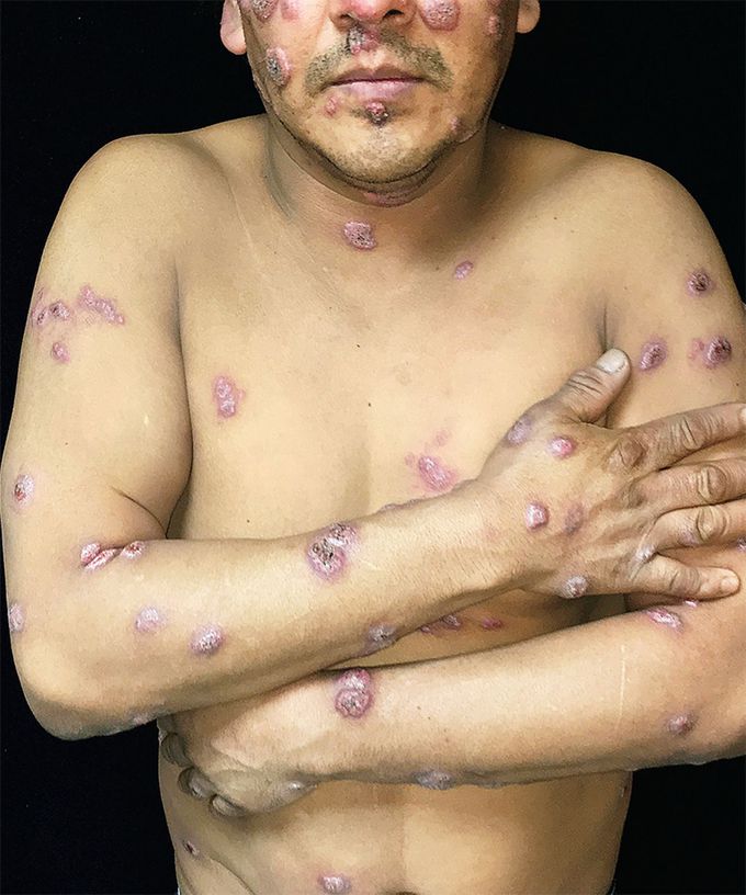 What is your diagnosis???