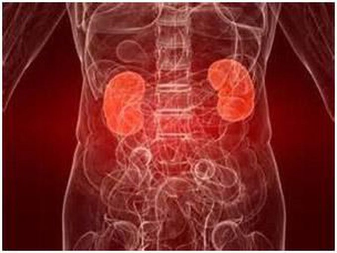 Nephrotic Syndrome