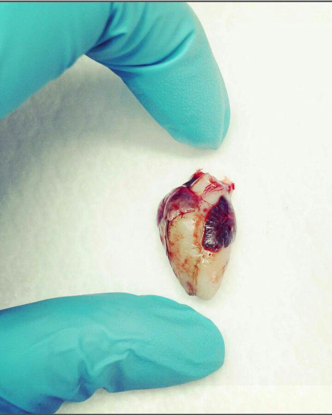 20wk old fetal heart!!