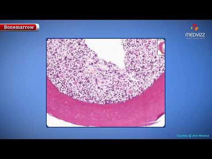 Histological view of bone marrow