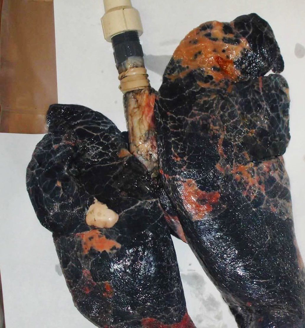 best way to get cigarette smoke smell out of clothes How To Get Rid of Cigarette Smoke Smell on Clothes best way to get cigarette smoke smell out of clothes How To Get Rid of Cigarette Smoke Smell on Clothes