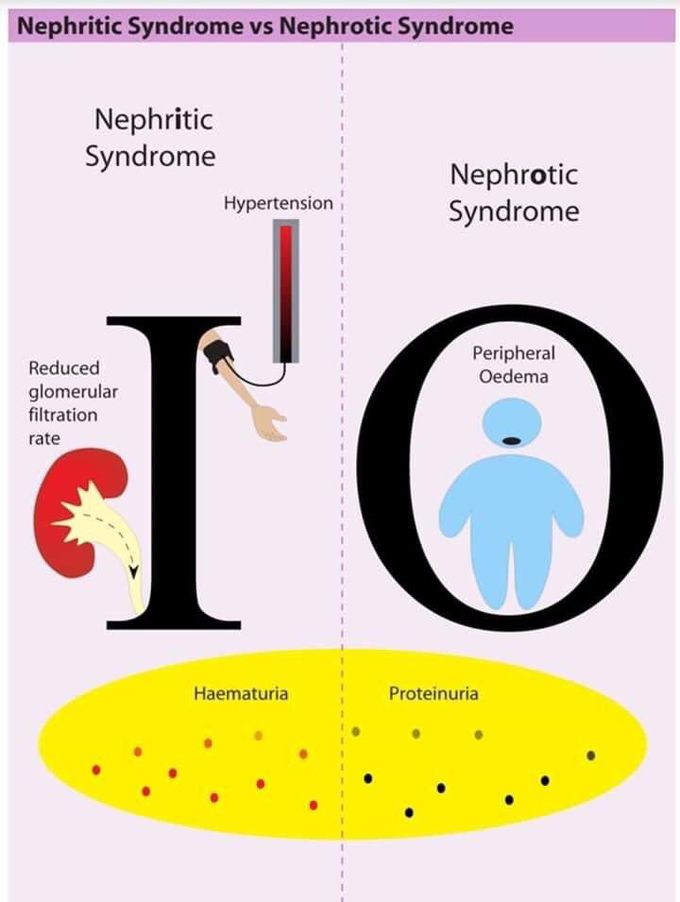 Difference between nephrotic and nephritic syndrome