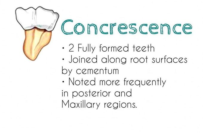 Concrescence
