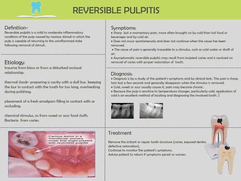 Pulpito revisible 2024