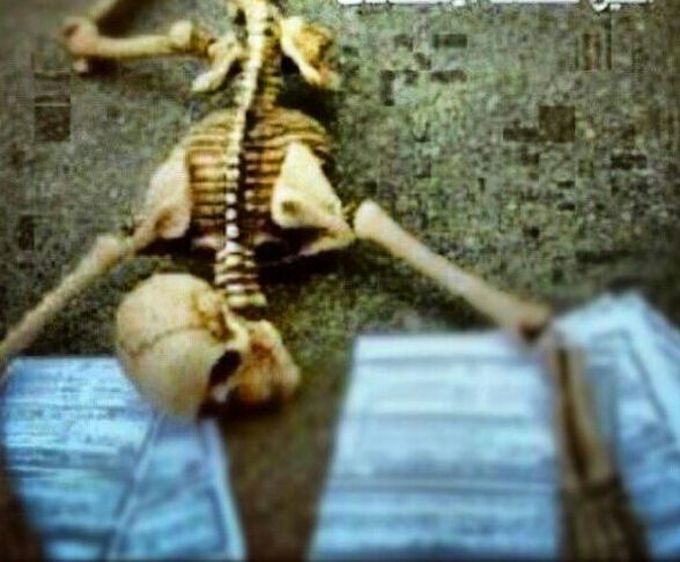 Short sad story of medical students😭😭