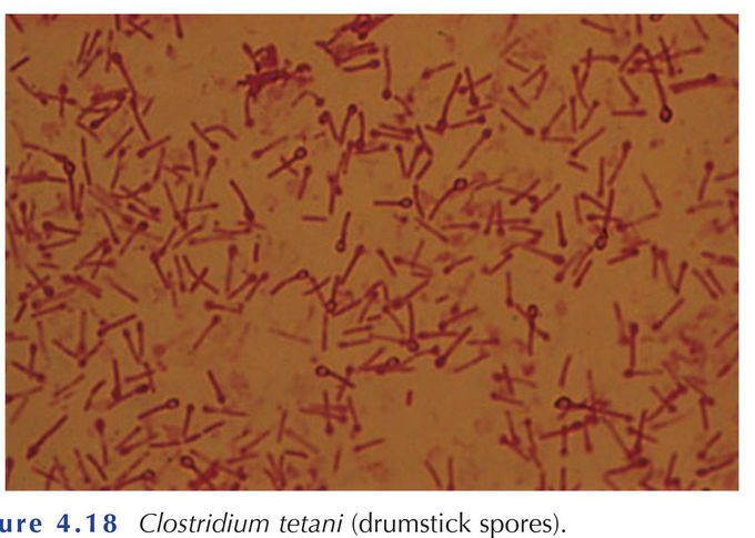 clostridium tetani spores