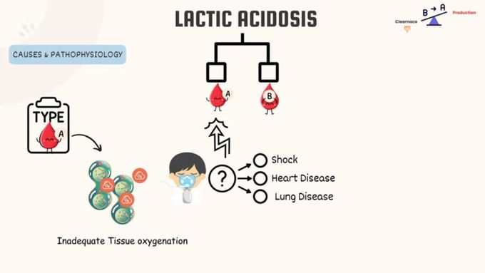 Understanding Lactic Acidosis: Causes, Symptoms & Treatment