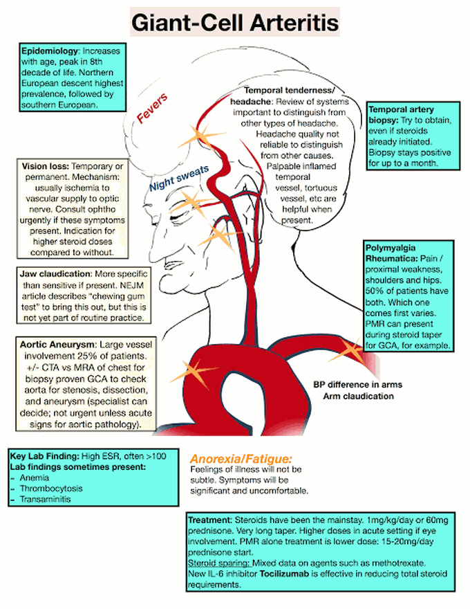 Gaint Cell Arteritis