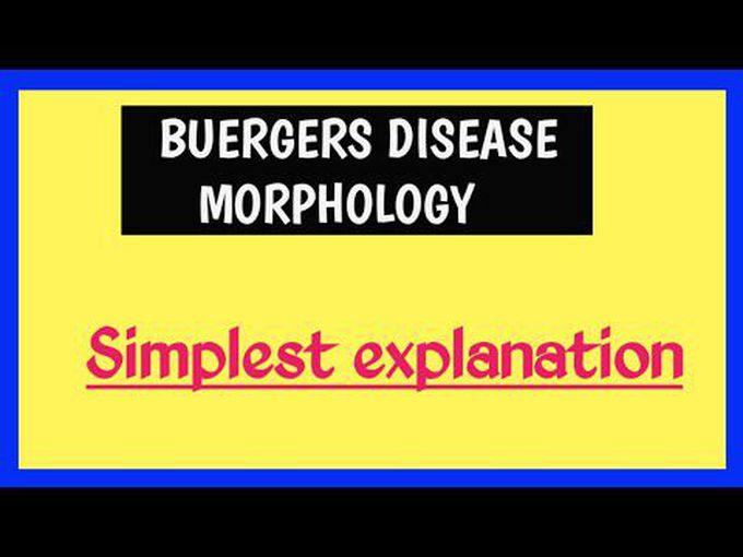Buergers disease-Pathology