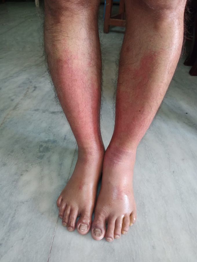 Diagnosis please