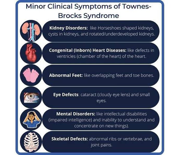 These are the major clinical symptoms of Brocks syndrome