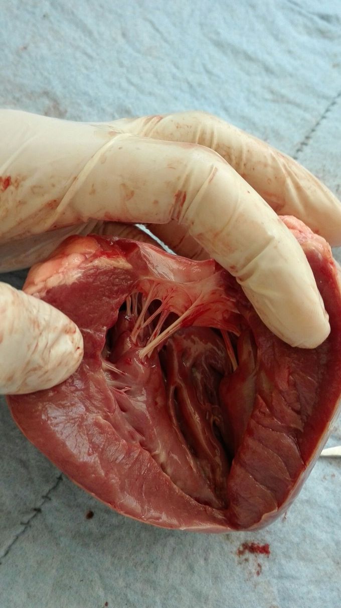 Hearth disection