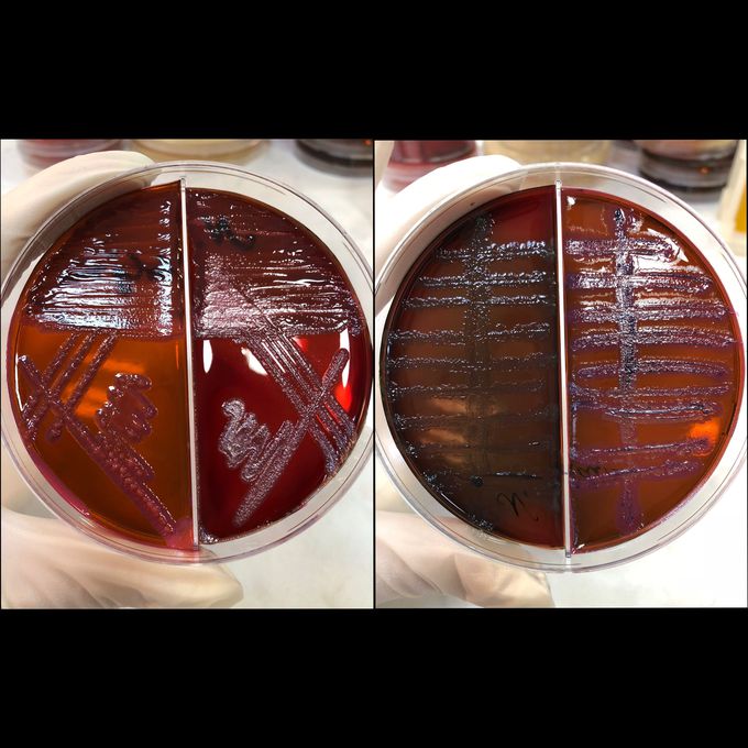 There are three types of Gram (-) bacteria in the sputum and urine cultivation of the patient who are in the Intensive Care unit. They are Pseudomonas aeruginosa, Klebsiella pneumoniae ssp. pneumoniae and Enterobacter spp. I made pure passage of each bacteria, identified them and put antibiotic susceptibility test (AST).