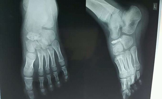 What is your diagnosis?