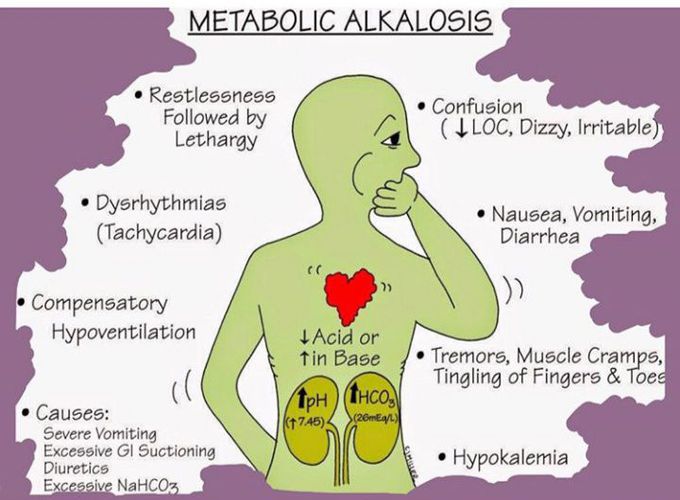 Metabolic alcolosis