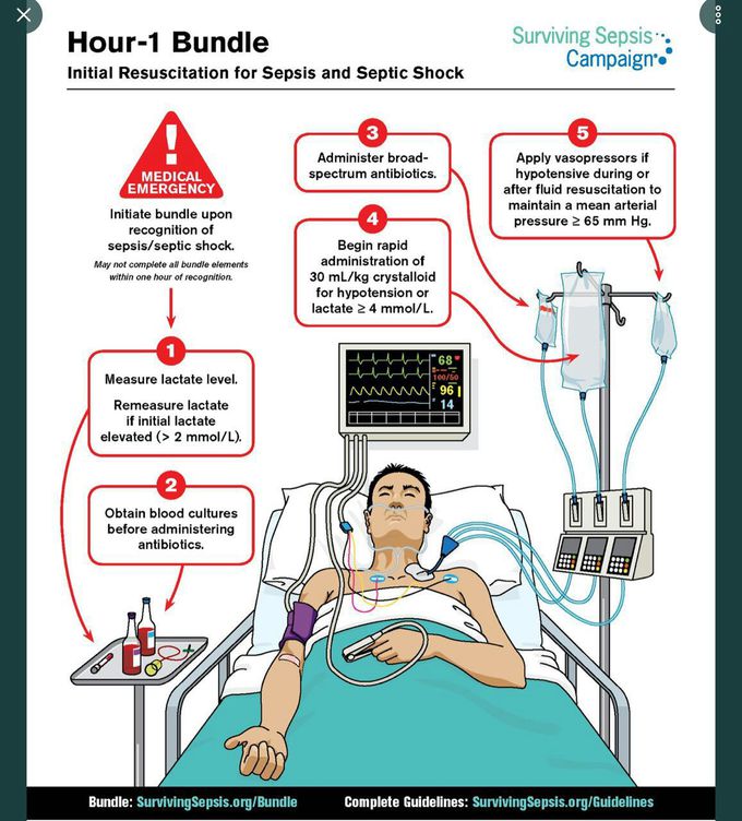 Hilal Alrabadi: Initial resuscitation for sepsis and septic - MEDizzy